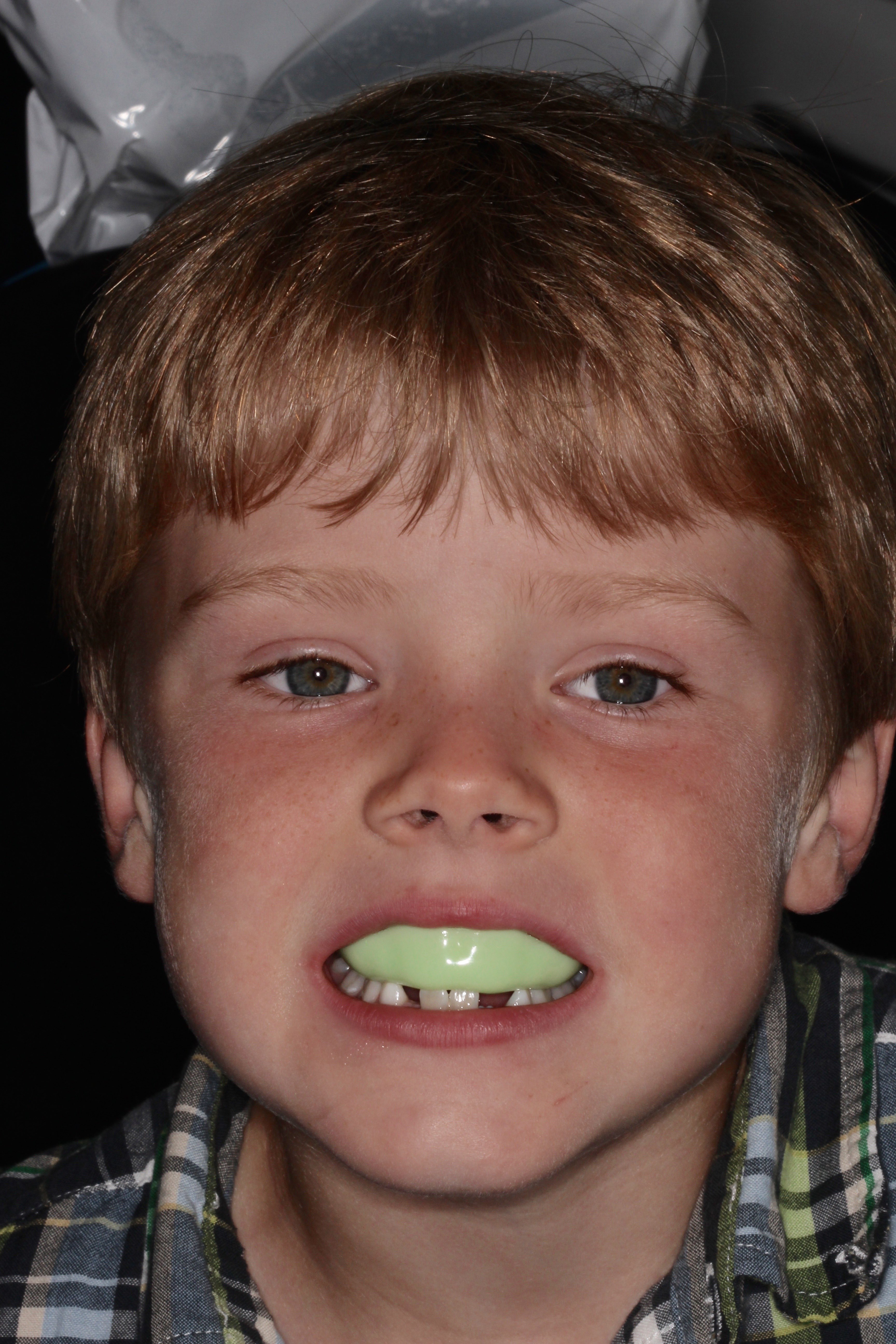 young boy with mouthguard